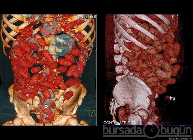 Akılalmaz X-Ray görüntüleri!