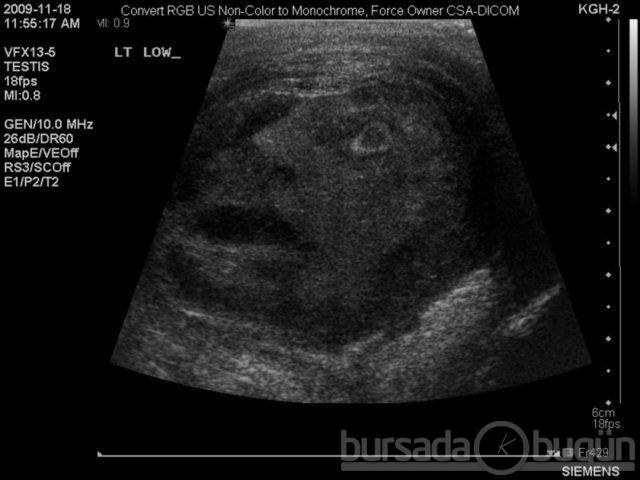 Akılalmaz X-Ray görüntüleri!