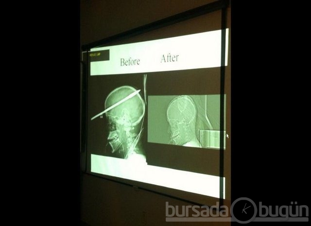 Akılalmaz X-Ray görüntüleri!
