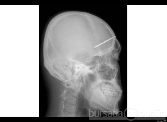 Akılalmaz X-Ray görüntüleri!