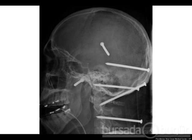 Akılalmaz X-Ray görüntüleri!