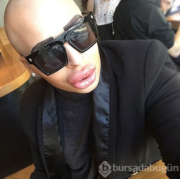 Kim Kardashian'a benzemek istedi!