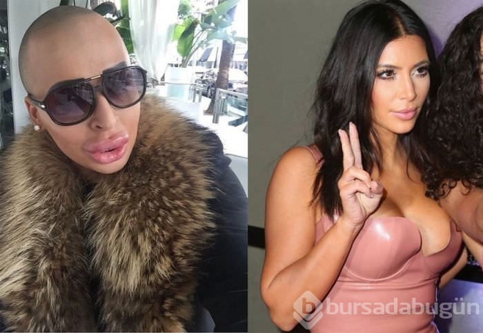Kim Kardashian'a benzemek istedi!