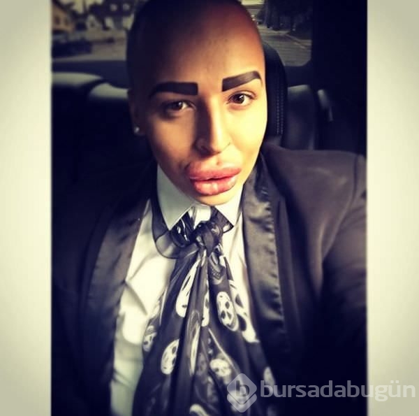 Kim Kardashian'a benzemek istedi!