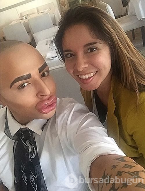 Kim Kardashian'a benzemek istedi!