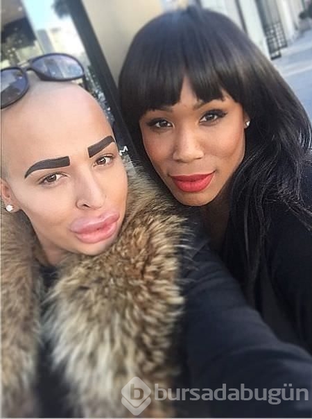 Kim Kardashian'a benzemek istedi!