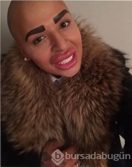 Kim Kardashian'a benzemek istedi!