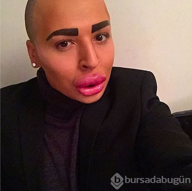 Kim Kardashian'a benzemek istedi!
