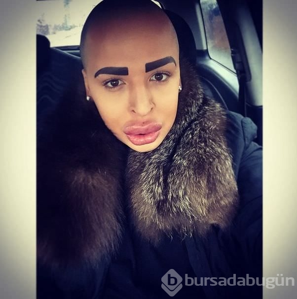 Kim Kardashian'a benzemek istedi!