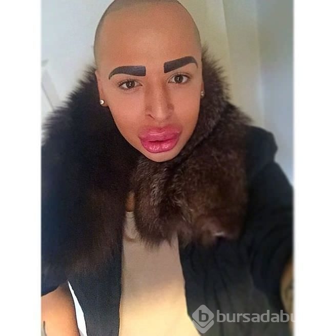 Kim Kardashian'a benzemek istedi!