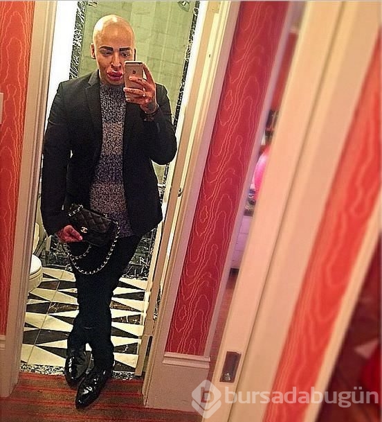 Kim Kardashian'a benzemek istedi!