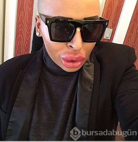 Kim Kardashian'a benzemek istedi!