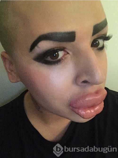 Kim Kardashian'a benzemek istedi!