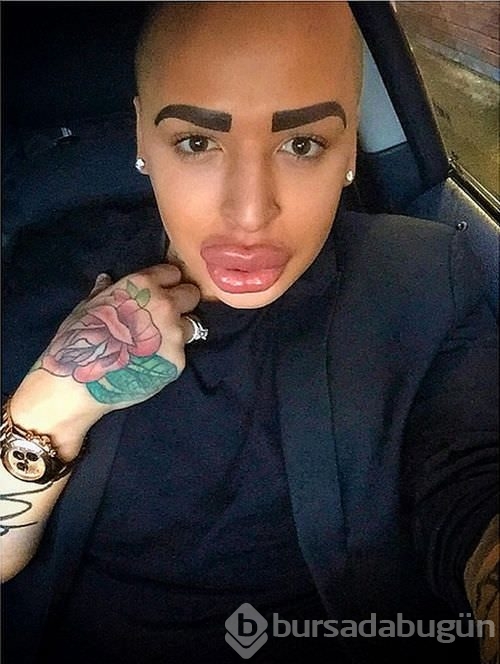 Kim Kardashian'a benzemek istedi!