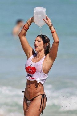 Seksi model kazaya kurban gitti...
