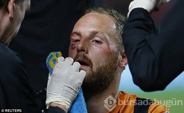 David Meyler gözünü kaybediyordu!
