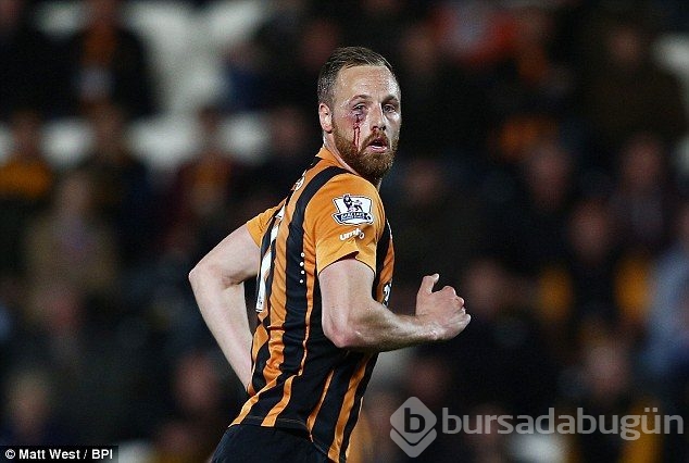 David Meyler gözünü kaybediyordu!