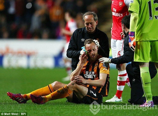 David Meyler gözünü kaybediyordu!