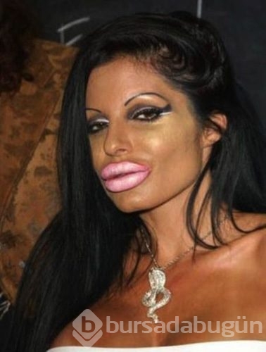 Estetik faciaları