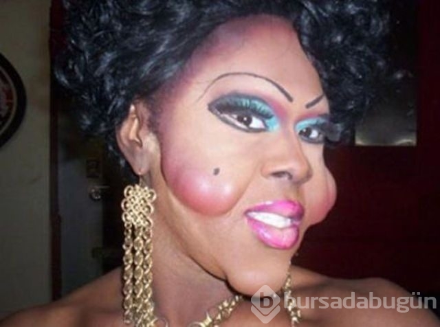 Estetik faciaları