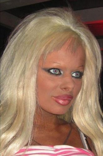 Estetik faciaları
