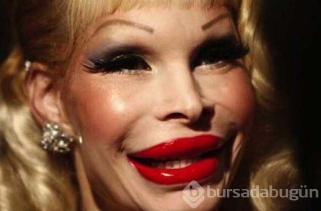 Estetik faciaları
