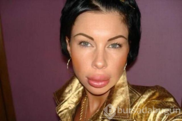 Estetik faciaları