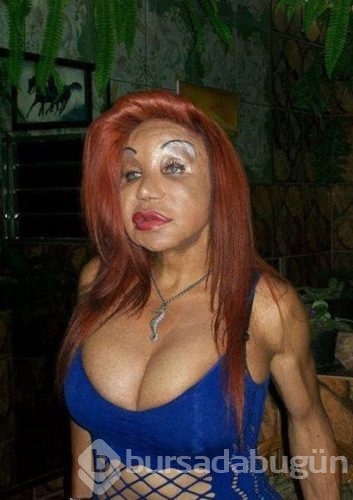 Estetik faciaları