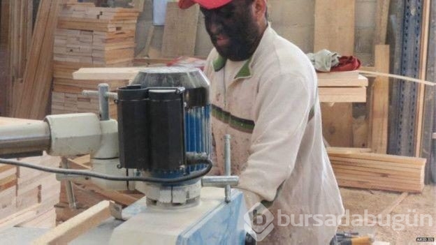 Bütün aile hipertrikoz hastası