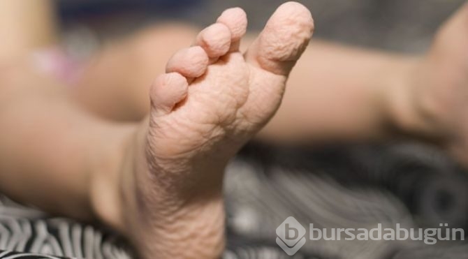 Eğer elleriniz böyle oluyorsa.. Aslında bu bir yetenek! 