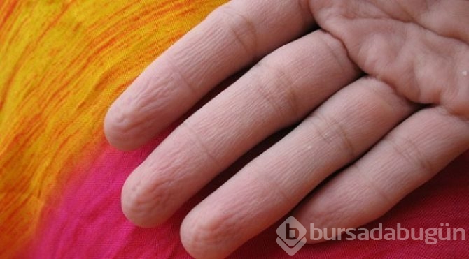 Eğer elleriniz böyle oluyorsa.. Aslında bu bir yetenek! 