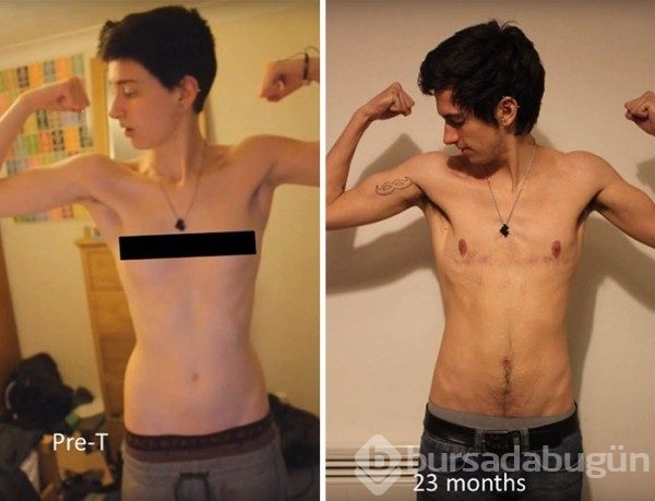 3 Yıl boyunca her gün çektiği selfie'ler eşliğinde bir kızın erkeğe dönüşüm süreci