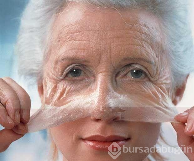Sarkık yanakları kaldırmak için öneriler