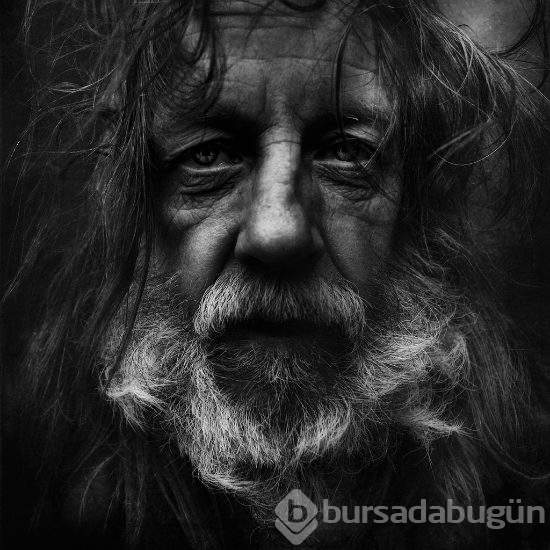 Parkinson hastalığı belirtileri ve tedavisi