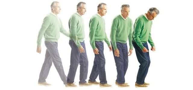 Parkinson hastalığı belirtileri ve tedavisi