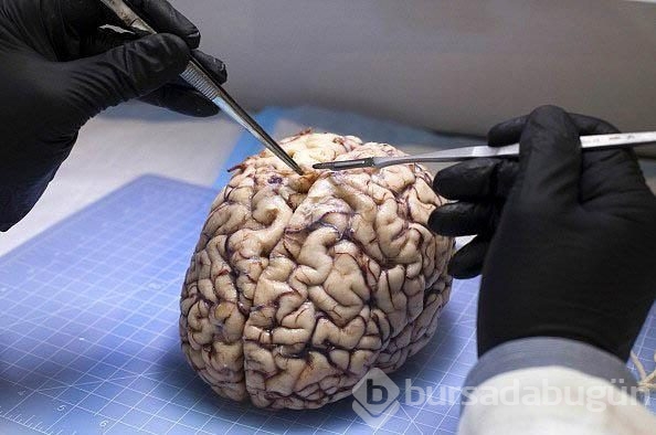 İnsan beyni hakkında bilmediğiniz 42 gerçek 