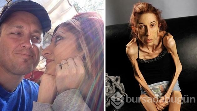 56 kilodan 18 kiloya düştü, böyle oldu!
