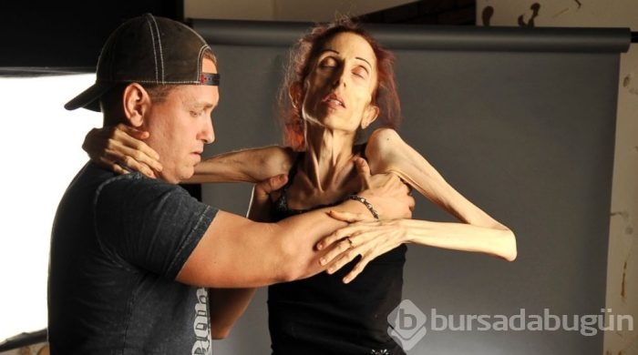 56 kilodan 18 kiloya düştü, böyle oldu!
