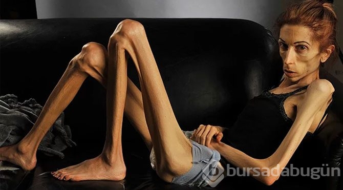 56 kilodan 18 kiloya düştü, böyle oldu!

