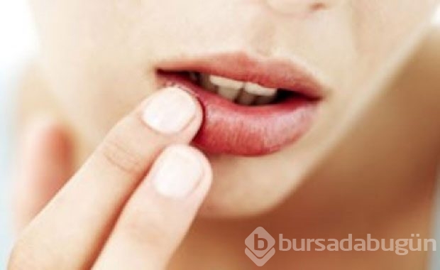Eğer sizin de gözünüz böyleyse DİKKAT!