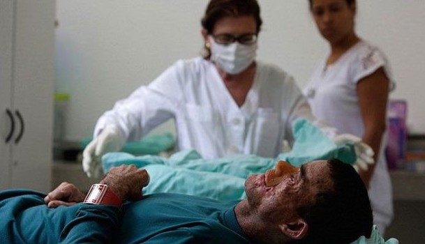 Bu köydeki herkes güneş görünce eriyor!