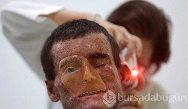 Bu köydeki herkes güneş görünce eriyor!