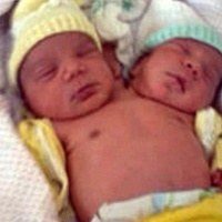 İki başlı mucize bebek