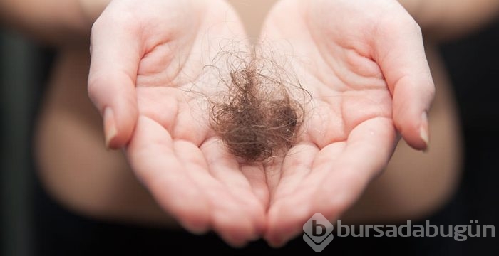 Saç dökülmesi neden olur, tedavisi nelerdir?