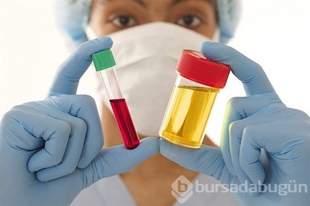 İdrar renginiz sağlığınız hakkında bilgi veriyor!