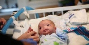 Mucize bebek Eli burunsuz doğdu