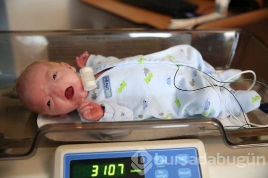 Mucize bebek Eli burunsuz doğdu