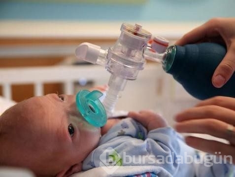 Mucize bebek Eli burunsuz doğdu