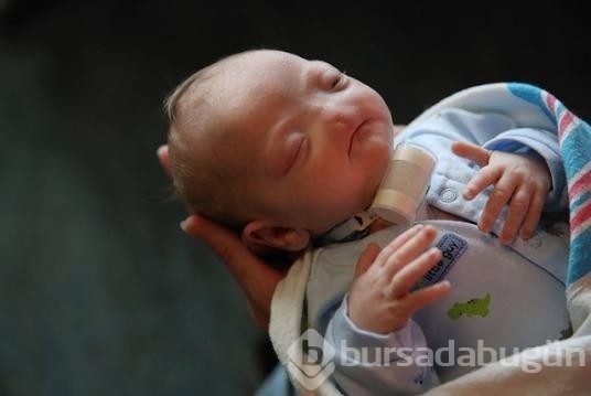 Mucize bebek Eli burunsuz doğdu