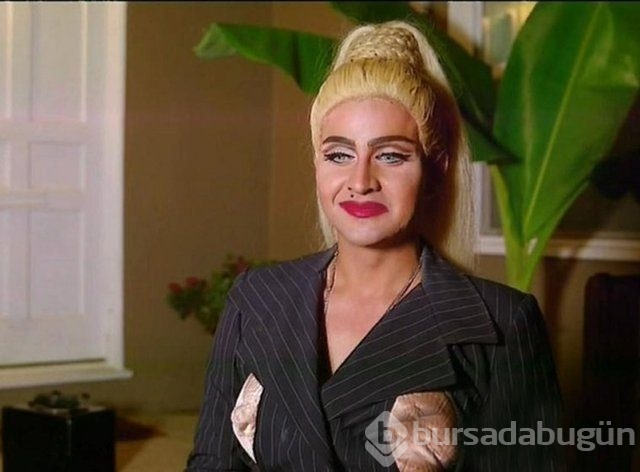 En gereksiz estetik ameliyatlar 